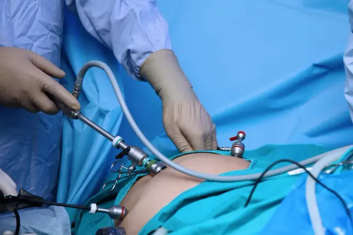 Minimal Access Laparoscopic Surgery A Complete Guide